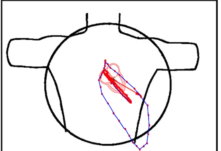 Figure 9: Le vectocardiogramme permet de suivre dans l’espace la trace du vecteur cardiaque au  cours du temps pendant les différentes phases caractéristiques du battement cardiaque