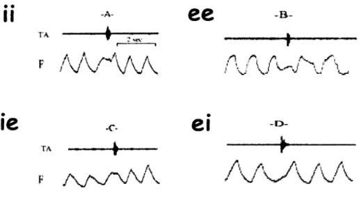 Figure  9  :  Classification  descriptive  des  DNN  d ’après  Reix  et  al.  2003.  Le  type  ii  dont  la  pause  induite  par  la DNN  commence  et  ce  termine  en  inspiration,  le  type  ee  dont  la pause  commence et  se termine  en expiration,  le