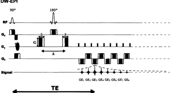 figure 2.1 - Schéma d'une séquence  d'acquisition DW-EPI  (Diffusion Weighted  Echo 