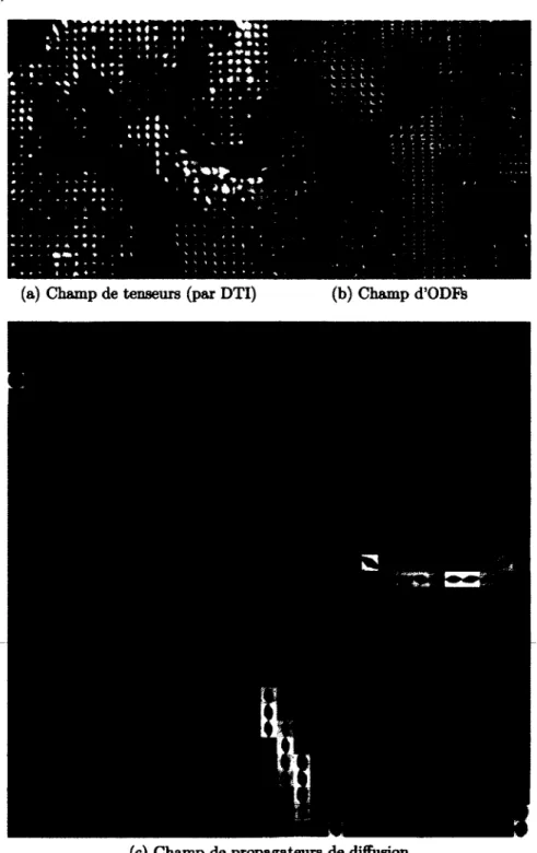 figure 2.5 - Champs de glyphes  de diffusion sur une tranche coronale. 