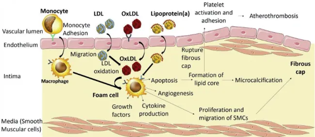 Figure 2. Résumé de la pathophysiologie de l'athérosclérose. Tiré de Arsenault et al, 2017