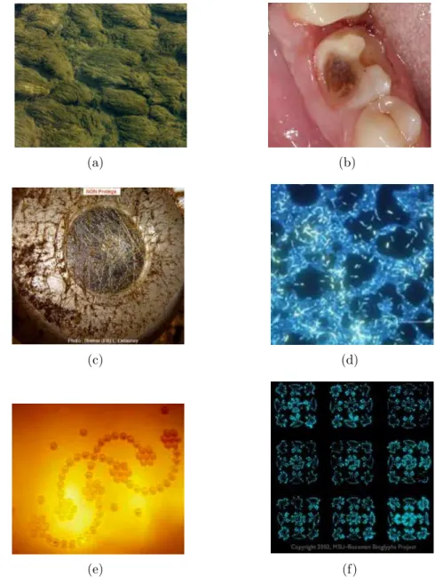 Figure 1 : Exemples de biofilms formés en milieu naturel (a) algues sur fond marin (b) carie dentaire (c) hublot de bateau (d) colonie de Légionelles dans une canalisation de chauffe eau (e-f) BIOGLYPHS, Images de biofilms, voir http ://www.microbialart.co