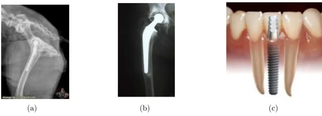 Figure 2 : Exemples de greffes de biomatériaux d’alliage de Ti ou d’acier inoxydable dans un tissu vivant (a) prothèse de hanche du lapin (b) prothèse de hanche de l’humain (c) implant dentaire
