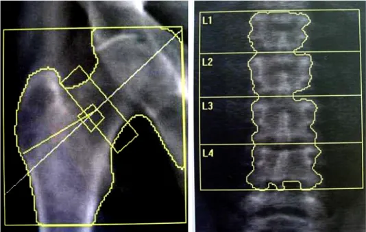 Figure 2.3 – Mesure de la DMO de la hanche (gauche) et du rachis (droite) en DXA