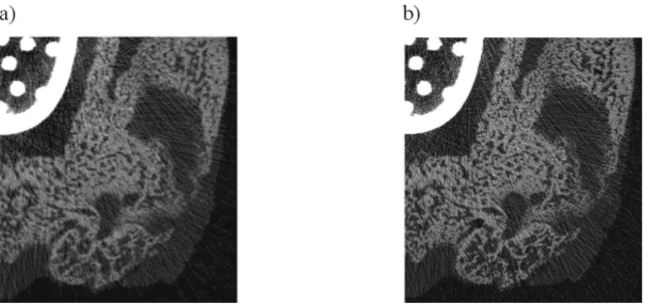 Figure II.23. Coupes issues d'un µCT : a) moyenne résolution et b) haute résolution.