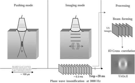 Figure 1.10. Principe de fonctionnement de l'élastographie par ondes de cisaillement ( Berco et al