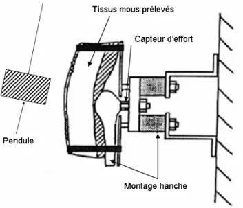 Figure 21 : Montage expérimental de simulation d'impact sur le grand trochanter recouvert de ses tissus  mous in-vitro [ROBI95] 