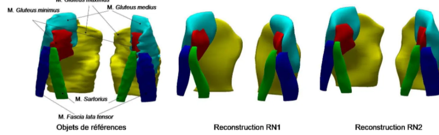 Figure 32 : Reconstruction (RN1) des muscles de la hanche pour le sujet 1 