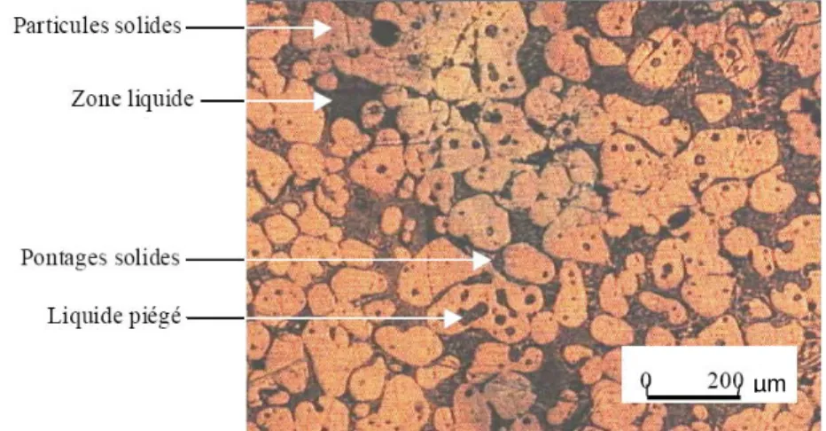 Figure I.21 :   Structure composée de différentes zones d’un semi-solide, solide,  liquide, solides pontés et liquide piégé, d’un alliage Sn-15%Pb [11]