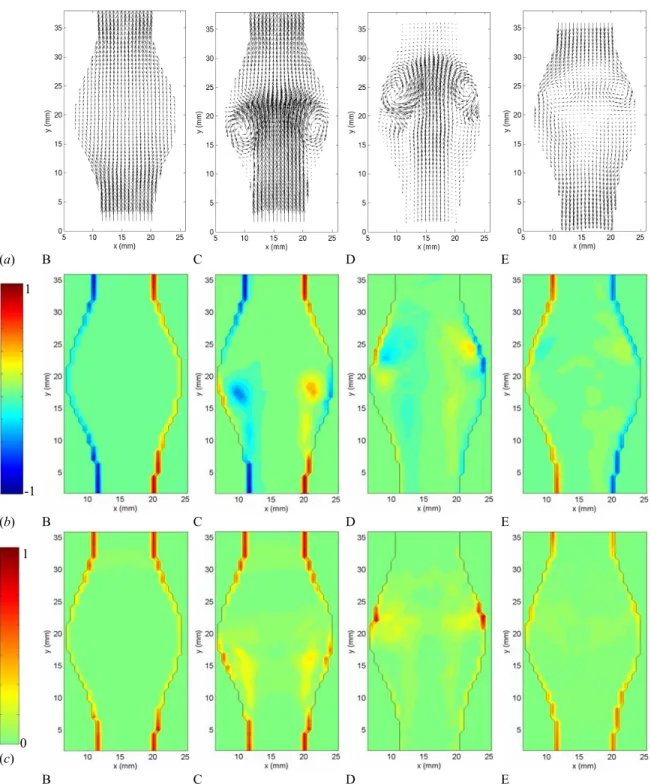 Figure 3.7: (a) Velocity, (b) vorticity and (c) stress fields, at times B to E, measured in  model 4 (D/d = 1.9, L/d = 2.9) and phase-averaged over 6 cardiac cycles