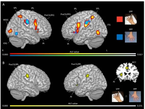 Figure  4.  Activation  likelihood  clusters  for  pain  empathy  experiments  using  SS  pain 
