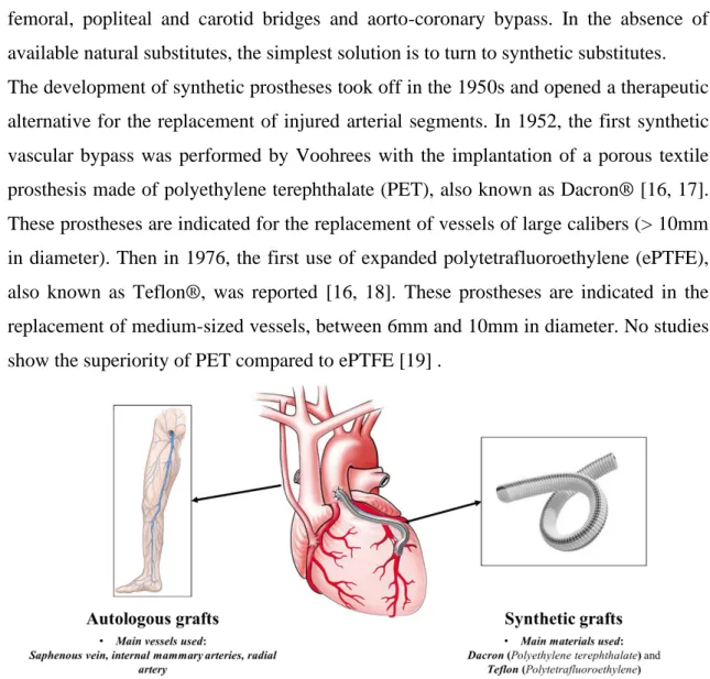 Figure 0.5: Bypass surgery: Use of autologous and synthetic grafts for bypass surgery