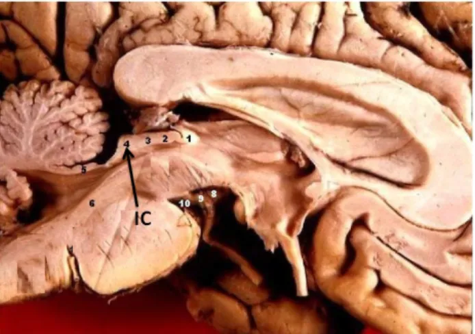Figure 2.4 The position of the IC in the brain [Commons, 2015]. It is located in the auditory midbrain.