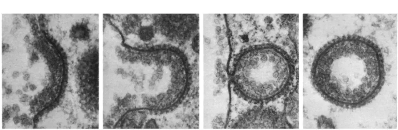 Figure 1.1: Electron microscopy images of clathrin endocytosis. The radius of a clathrin-coated vesicle is 150nm