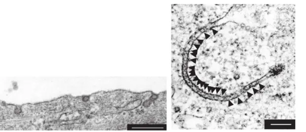 Figure 1.2: Electron microscopy images of (left) adsorbed viruses on the membrane and (right) tubules formed by viruses in a cell