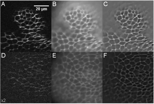 Figure I.15 – Disques imaginaux de drosophile marqués à l’Alexa488, observés à deux profondeurs (0 (A-C) et 40 µm (D-F)), en coupe optique (A, D), en plein champ (B, E) et avec un filtrage passe-haut (C, F) (pour chaque méthode, les images à 0 et 40 µm son