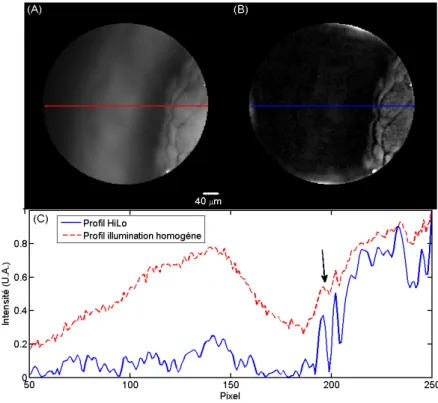 Figure I.19 – Images de coupe optique sur un embryon de Xénope : A) image en illumination uniforme, B) image HiLo