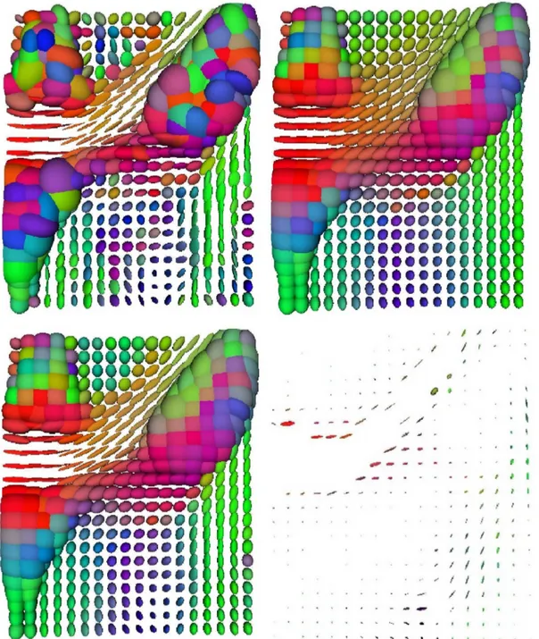 Figure 4.5: Regularization of a clinical DTI volume (3D). Top Left: close-up on a slice containing part of the left ventricle and nearby
