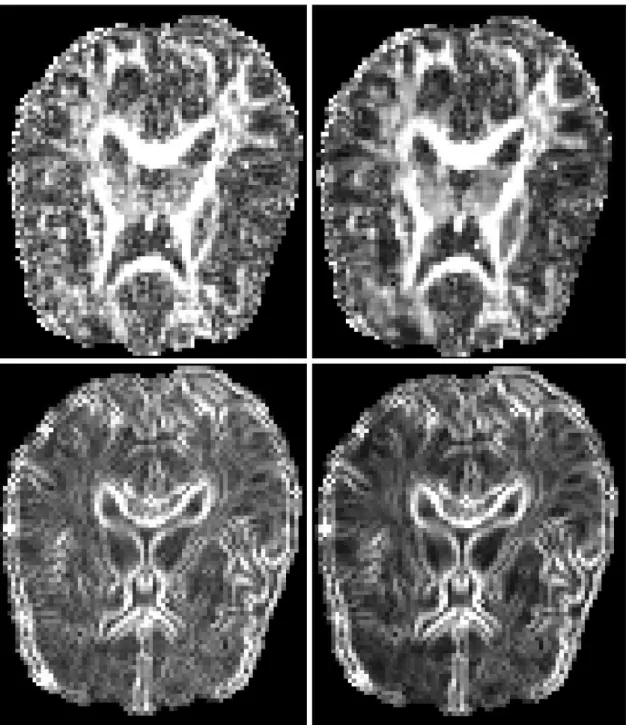 Figure 4.6: Log-Euclidean regularization of a clinical DTI volume (3D): typical eect on FA and gradient