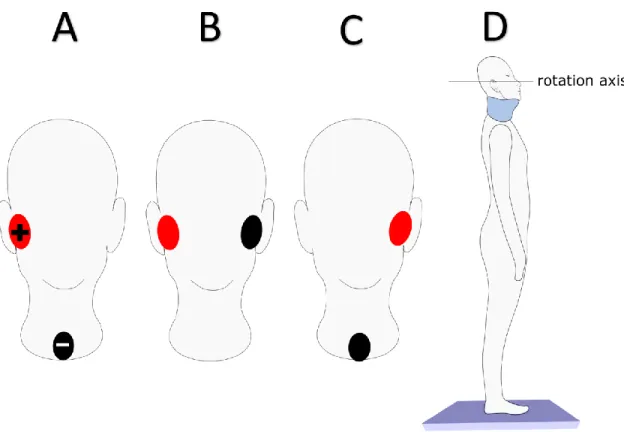 Figure 2-1: Electrodes placement to stimulate the left (A), both (B) or the right (C) 