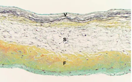 Figure 4 : Une coupe histologique de la valve aortique mettant en évidence les trois couches des 