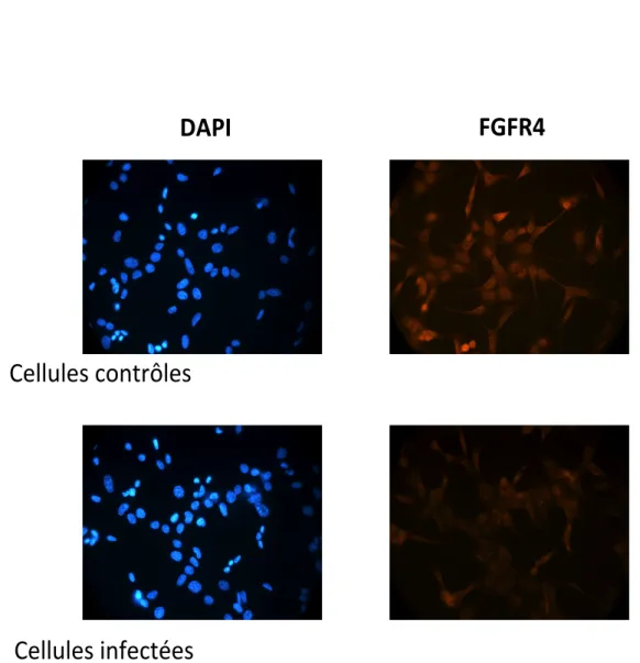 Figure  8.  Perte  de  l’expression  de  FGFR4  dans  des  cellules  AML-12  infectées  observées par immunofluorescence