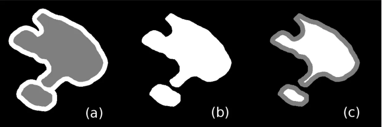Figure 1.7: Effects of the morphological dilation and erosion on a dummy set (b): the dilation enlarges the set and closes small gaps as in (a), the erosion makes the set