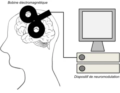 Illustration 1. Appareil de neuromodulation magnétique 
