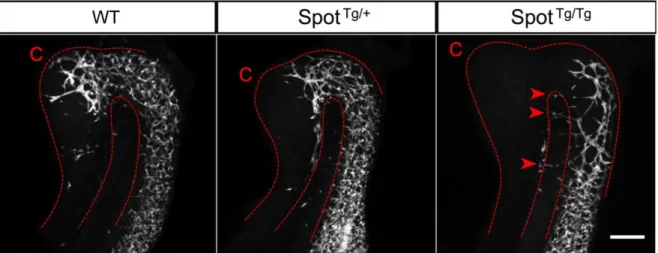 Figure S3. Migration of Spot Tg/Tg  ENCCs via the transmesenteric route. Confocal imaging of  e11.5 embryonic guts in the G4-GFP transgenic background shows that ENCC migration through  the mesentery separating the midgut and hindgut segments occurs in Spo