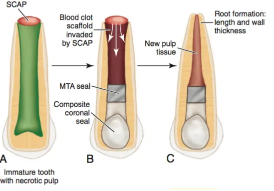 Figure  5.  Les  différentes  étapes  de  la  revascularisation.  A)  Dent  permanente  immature,  non  vitale,  montrant  la  papille  apicale  riche  en  cellules  souches,  SCAP  (stem  cells  apical  papilla)  au  niveau  de  l’apex