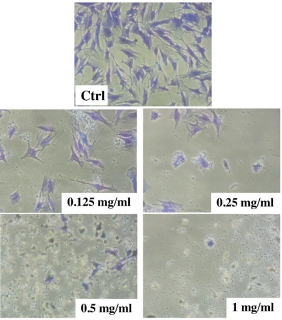 Figure  10.  Analyse  microscopique  de  l’effet  du  double  antibiotique  sur  les  DPSC