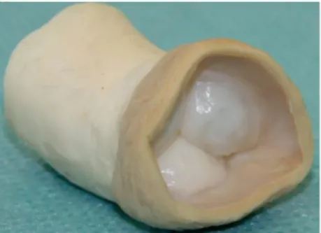Figure 9 : Valve AutoTissue Matrix P®, adapté de [49]. 
