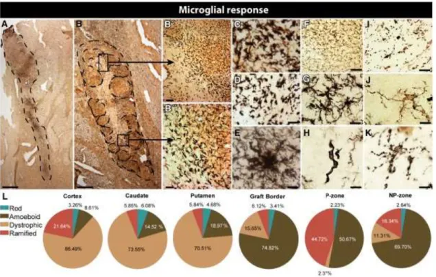 Figure 1-2. Inflammatory response to cell suspension grafts 