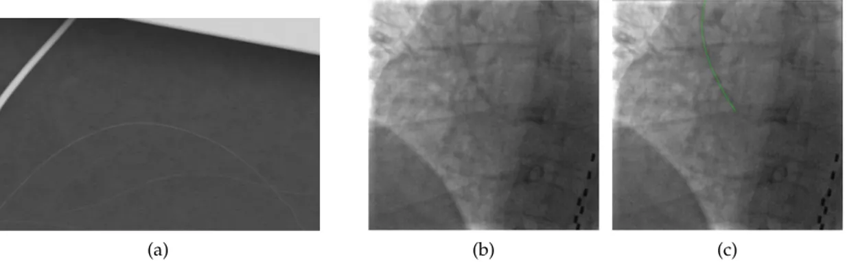 Figure 3: A few examples of challenging curvilinear structure detection. (a) An electron mi- mi-crograph of glass fibers