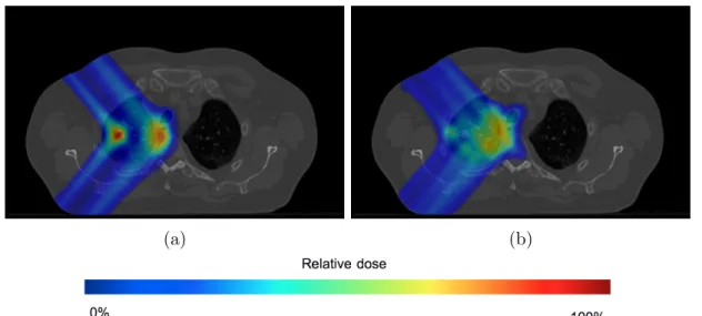 Figure 2.6 – Distributions de dose calcul´ ees pour un patient statique ( 2.6a ) et un patient mobile ( 2.6b ) dans MSPT.