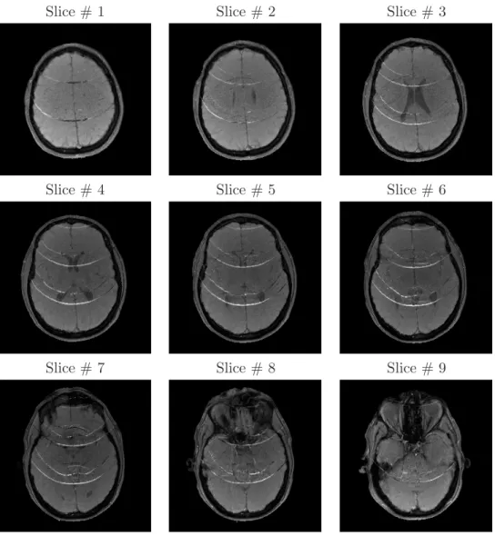 Figure 2.19: GE anatomical data: reconstructed adjacent slices using SENSE for R = 4.