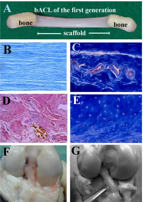 Figure 1: (A): A bACL of the first generation grafted successfully in the goat model for 6 