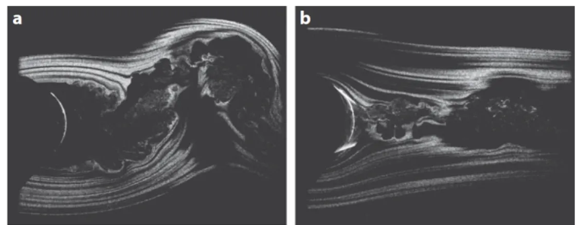 Figure 1.3: Flow past a cylinder at R e = 33000. (a) uncontrolled, (b) controlled by plasma actuators aiming at separation control.