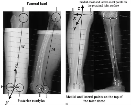 Figure 38 : Méthode de détermination des repères liés aux fémurs et tibia. [Sato et coll