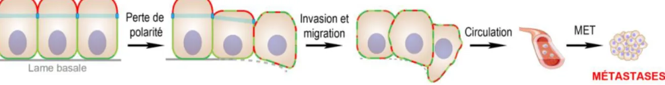 Figure 3. Transition épithélio-mésenchymateuse et cancer. L’EMT est caractérisée par une perte de caractéristiques 