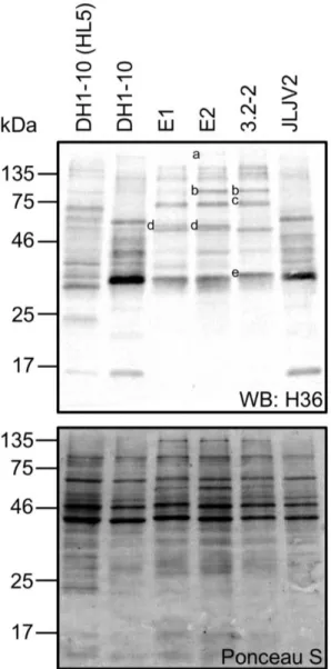 Figure 1.5. The H36 antibody displays  different protein band patterns in the  amoeboid  isolates