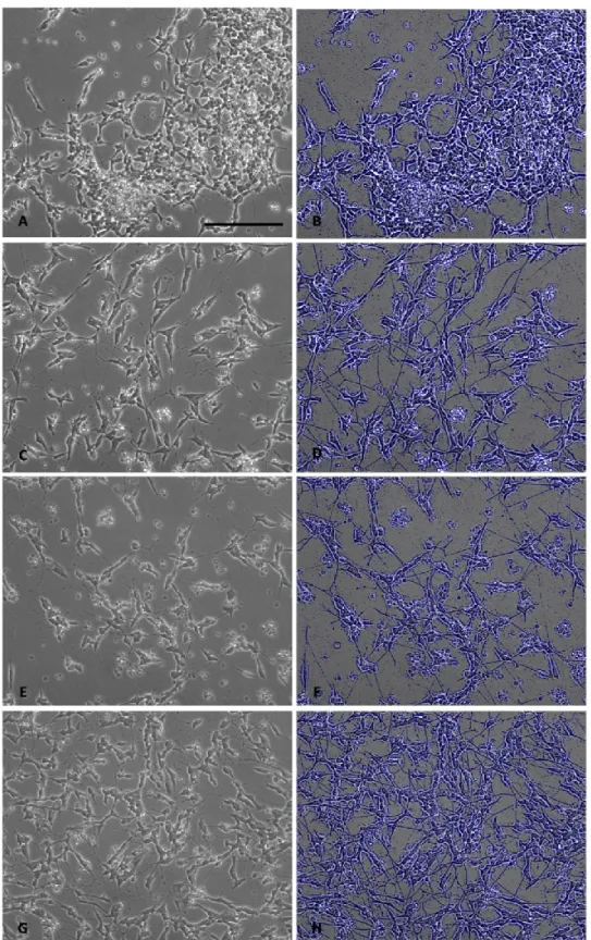 Figure 2-5 : Effects of BMP-9 and pBMP-9 on SH-SY5Y morphology after 72h of incubation (A) Control, (C)  Control + AR (10 µM), (E) BMP-9 (1nM) + AR (10 µM) and (G) pBMP-9 (1nM) + AR (10 µM)