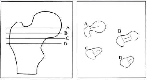 Figure 12 : Différentes coupes et axes pour le calcul de la torsion fémorale [Sugano et al