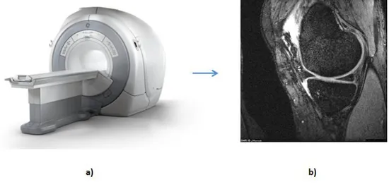 Figure 17 : a) Machine moderne d’IRM. b) exemple de coupe 2D du genou avec ce type de machine 