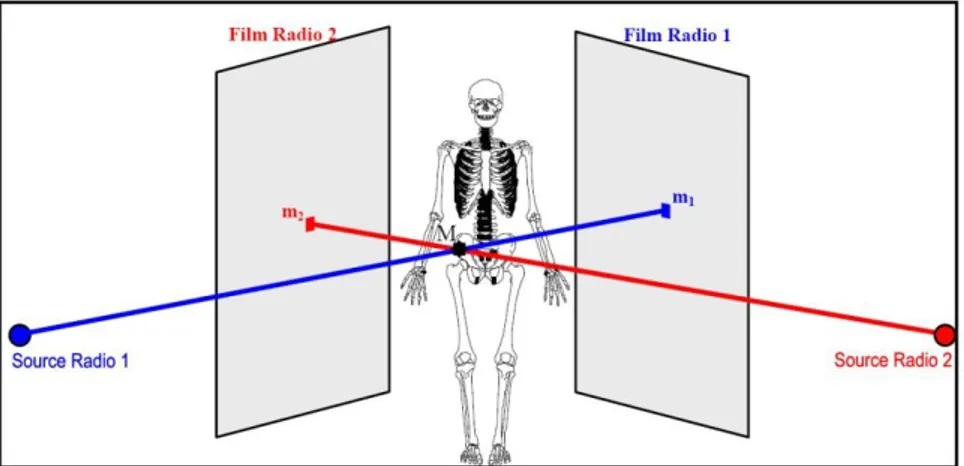 Figure 18 : Principe générale de la reconstruction 3D à partir de la radiographie biplane [Humbert et al