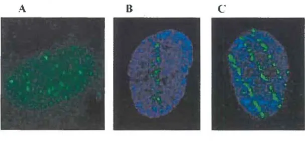 Figure  2 :  Foyers de y-H2AX  fluorescent  chez  des  fibroblastes  humains  10 min  post- post-irradiation avec (A) Rayons-y, 2 Gy;  (8)  28 Si 14 +,  54 keV/µm, 0.5 Gy et (C)  56 Fe 26 +,  176 