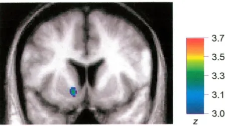 Figure 8. Merged PET-MRI image illustrating CBF increase averaged for all nine subjects when EXPT4 was compared to the 1-Move control condition