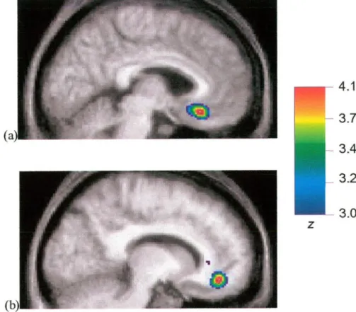 Figure 10. Merged PET-MRI images illustrating CBF changes averaged for all nine  subjects when the measure of total time was again regressed against rCBF  over the four experimental conditions