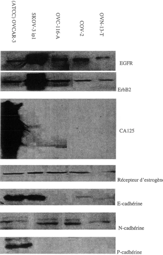 Figure 9 : Expression de différents marqueurs cellulaires par immunobuvardage de type Western  dans des nouvelles lignées de cancer ovarien