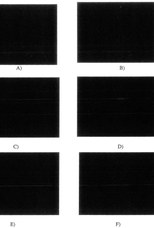 Figure 11: Visualisation du marqueur CA 125 sur des sphéroïdes par immnufluorescence indirecte sur  lame